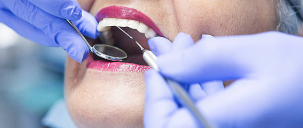 Best Emergency Root Canal Treatment in Beecher, IL